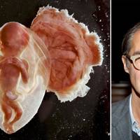 Bild av foster av Lennart Nilsson och Aris Fioretos, författare