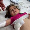 En skadad flicka på sjukhus i Rafah