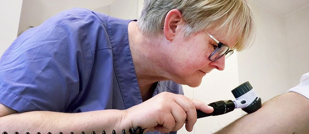 sjuksköterska specialiserad på hud i blå kläder undersöker arm på man