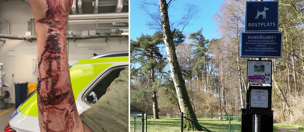 Tvådelad bild. Tillvänster en hundbiten och blodig arm. Till höger en hundrastgård med öppen grind.