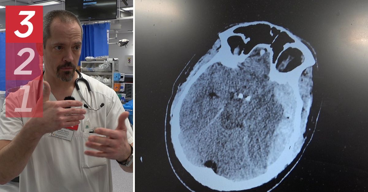 Så vill läkaren minska skador från elsparksolyckor