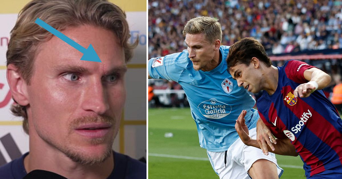 Carl Starfelt fick dobbar i ansiktet: &rdquo;Tur&rdquo;