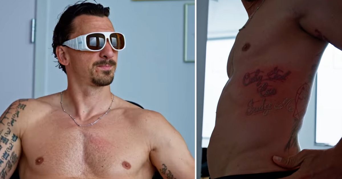 Här lasrar Zlatan bort kända tatueringen