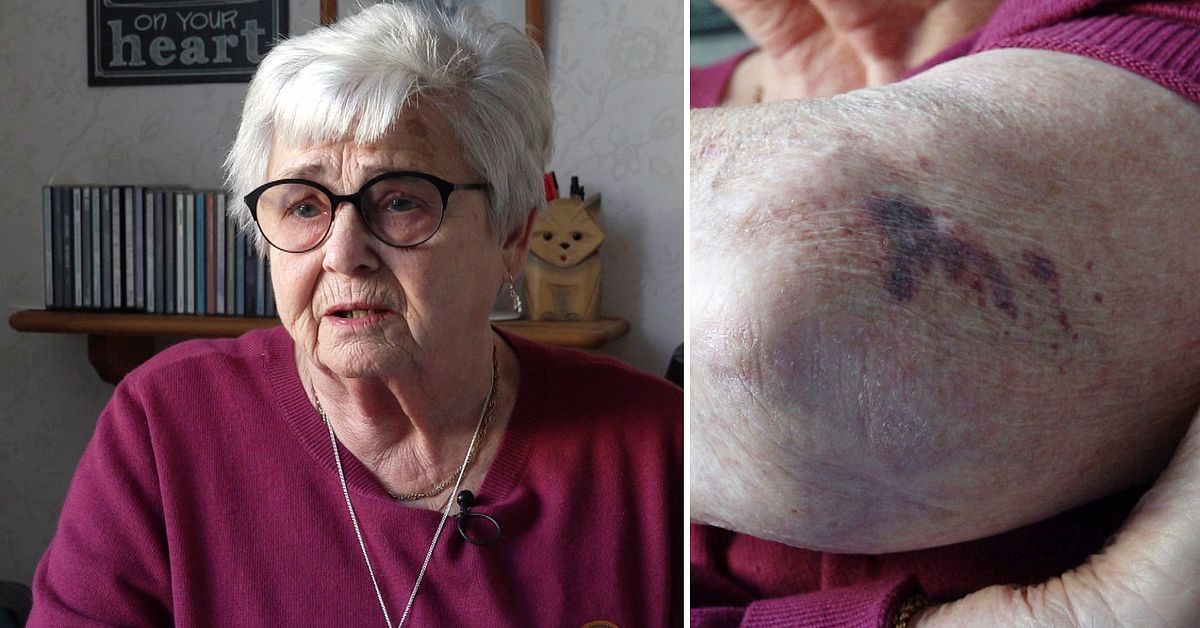 Rosmarie, 82, f&ouml;ll p&aring; bussen &ndash; tvekar om hon v&aring;gar &aring;ka igen