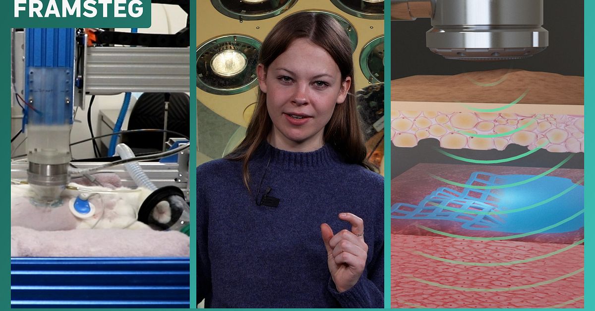 Framtidens kirurgi: Revolutionerande 3D-printing direkt i kroppen för skräddarsydda behandlingar