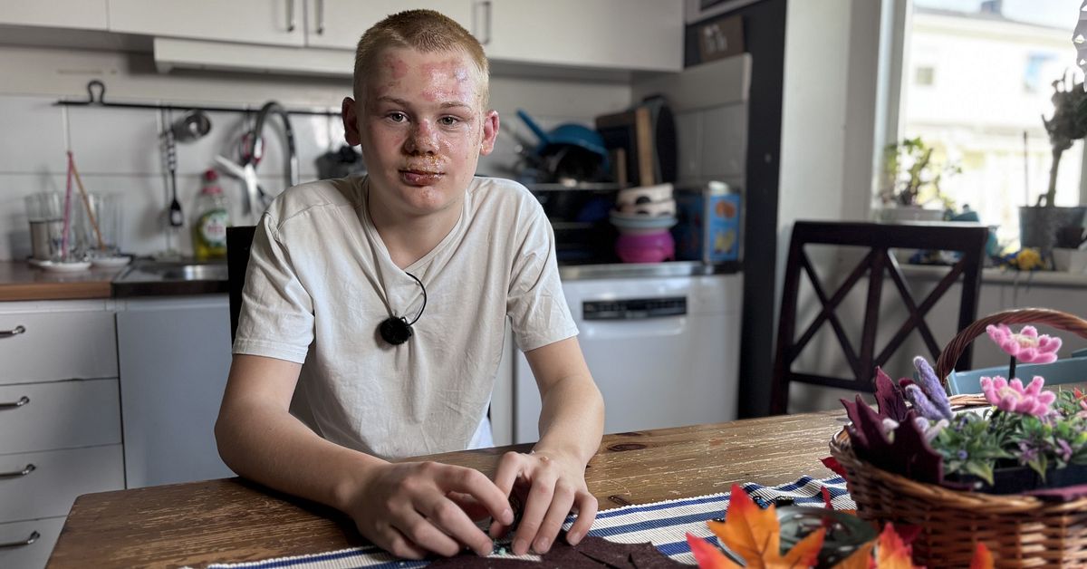 Teen describes escaping Fristad garage fire that injured seven boys