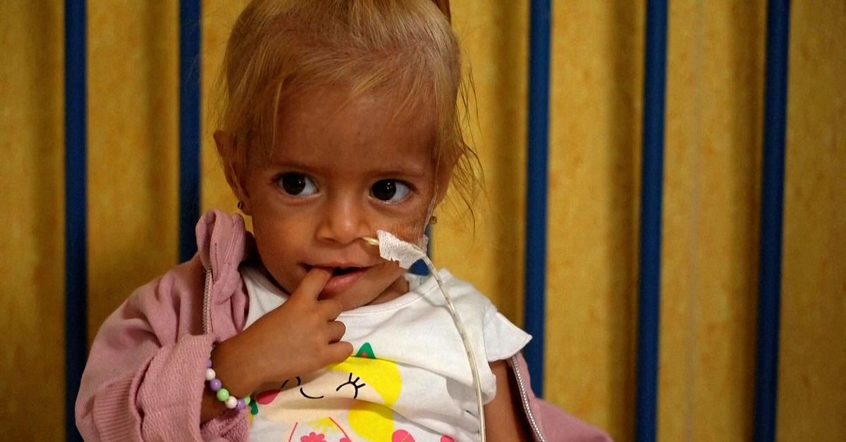 Tvååriga Shamm nära att svälta ihjäl – återhämtar sig i Italien ...