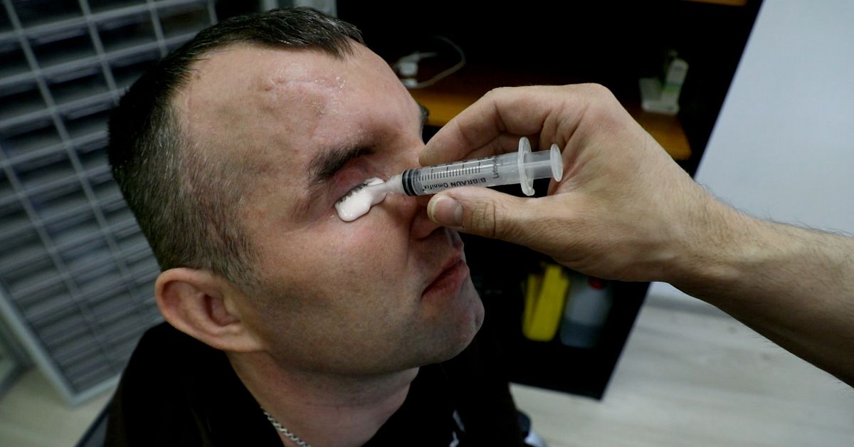 Här får ukrainska soldater sina ansikten tillbaka – med hjälp av 3D-teknik