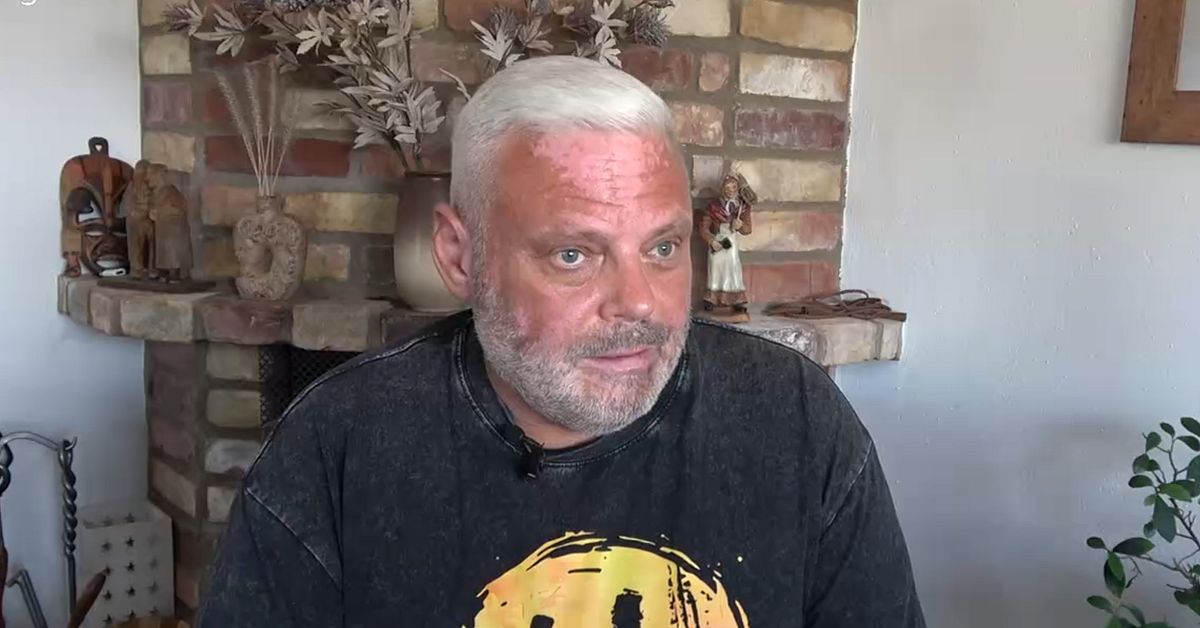 Anders fr&aring;n &Auml;ngelholm blev f&ouml;rlamad efter operation &ndash; st&auml;mmer Region Sk&aring;ne
