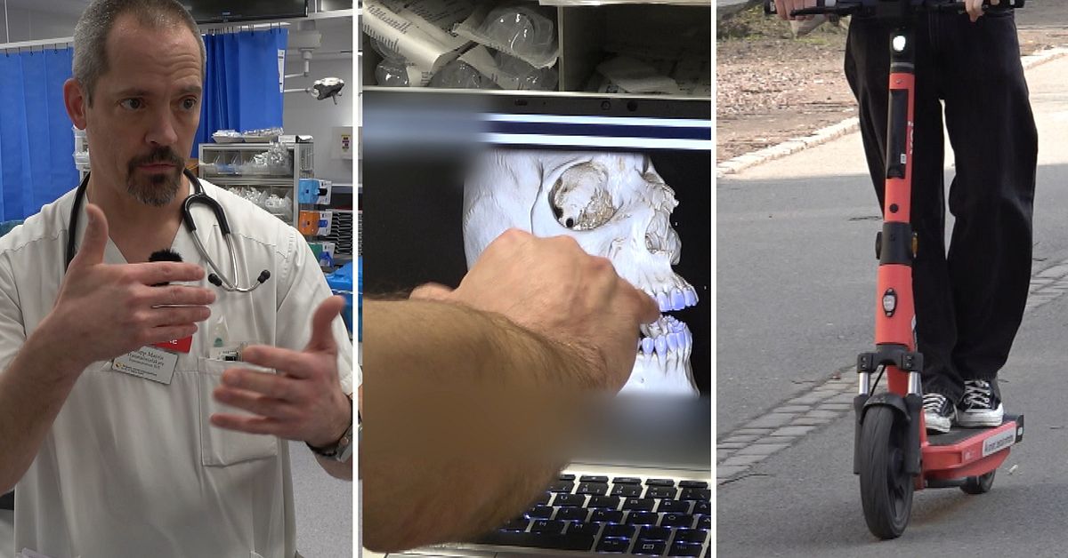 Vården larmar: Fler skadas svårt i elsparksolyckor