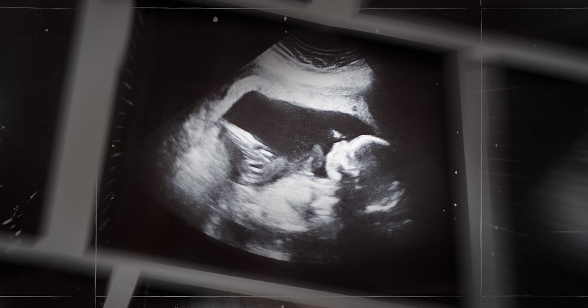 Fostertest f&ouml;r gravida d&ouml;ms ut av experter: &rdquo;Absurt&rdquo;