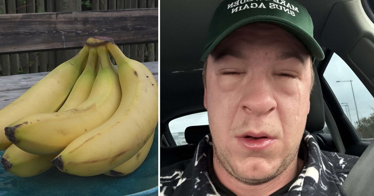 Sebastian, 26, fick livshotande bananallergi: ”Svårt att andas”
