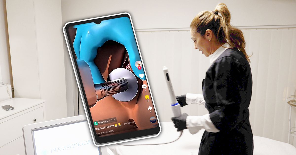 Str&aring;lning i underlivet g&ouml;rs trots varningar: &rdquo;Kan ge br&auml;nnskador&rdquo;