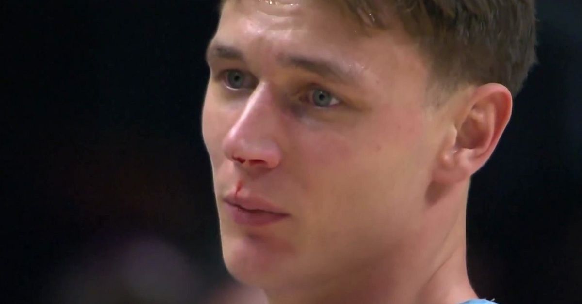 Pelle Larsson knockad igen &ndash; b&ouml;rjade bl&ouml;da