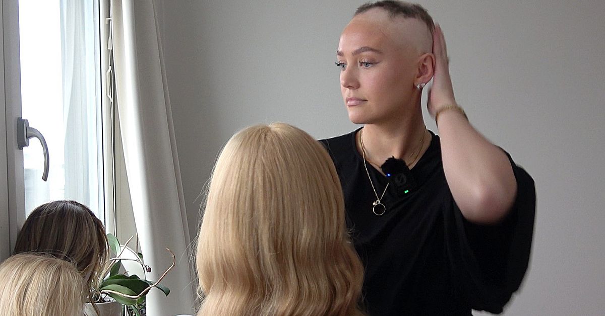 Alva, 23, lever med alopecia &ndash; tappade h&aring;ret som ton&aring;ring