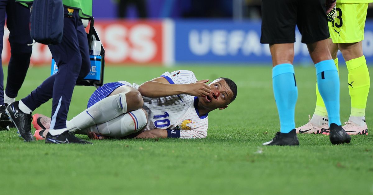 Calcio: il messaggio di Kylian Mbappe dopo il brutto schiaffo