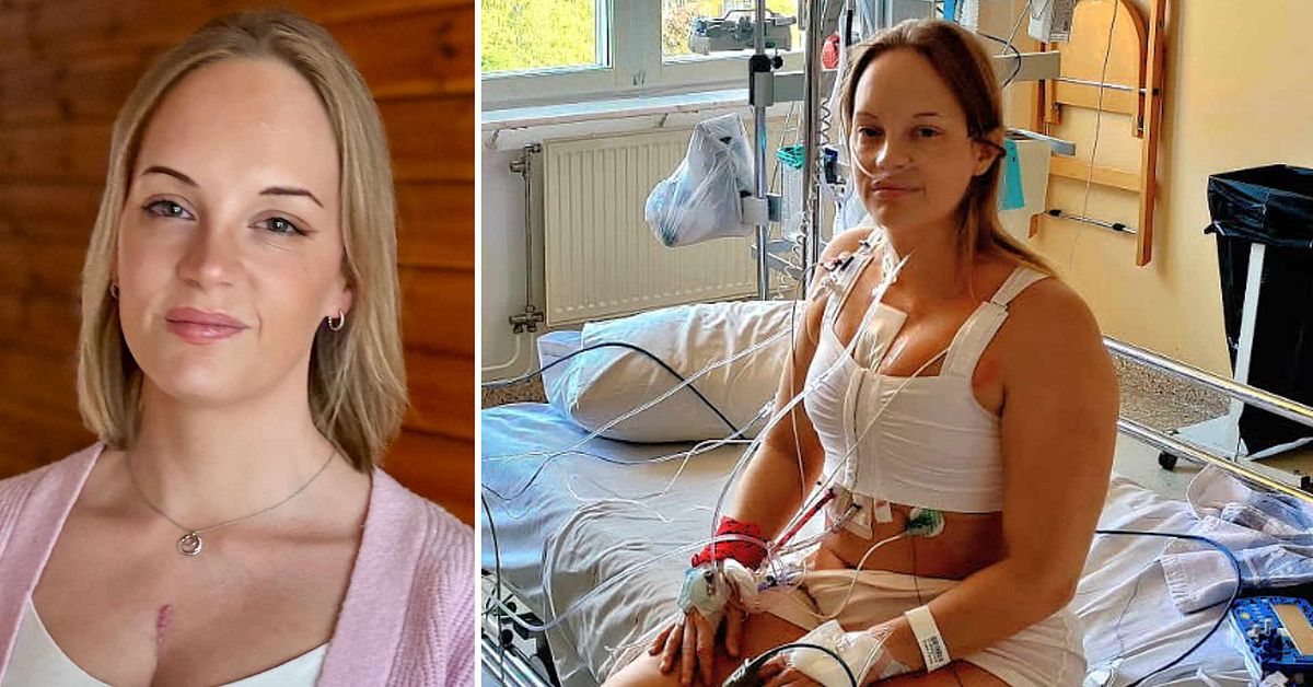 Emelie, 29, opererades f&ouml;r medf&ouml;tt hj&auml;rtfel: &rdquo;Stolt &ouml;ver &auml;rret&rdquo;