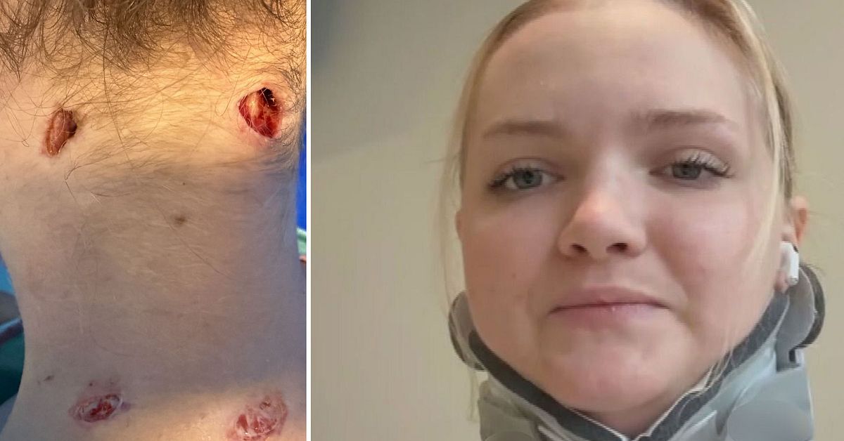 Naemi från Malmö attackerades av ett lejon – ”Känns osannolikt”