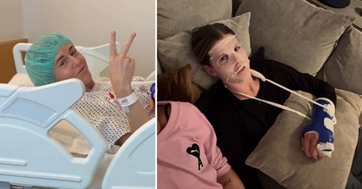 Olivia Schough opererad efter skada på träning – snubblade på koner