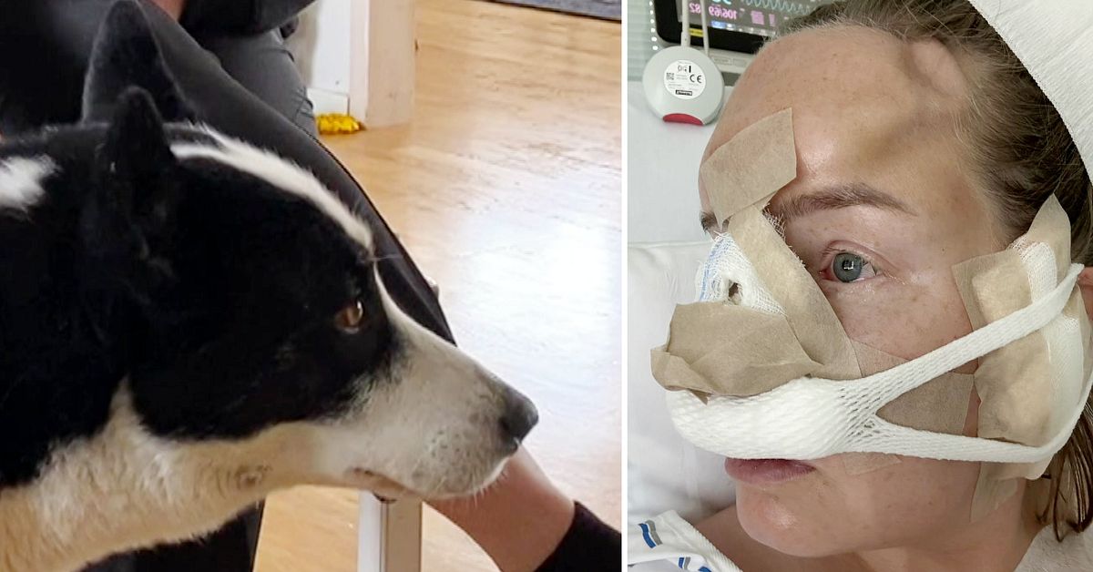 Hunden bet av Charlottas näsa – nu har hon fått en ny