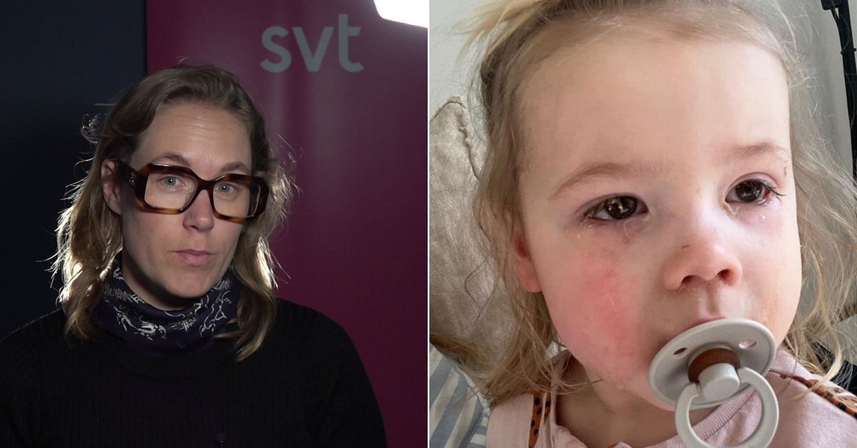 Vabba för ögoninflammation – så kan du (försöka) förkorta förloppet ...