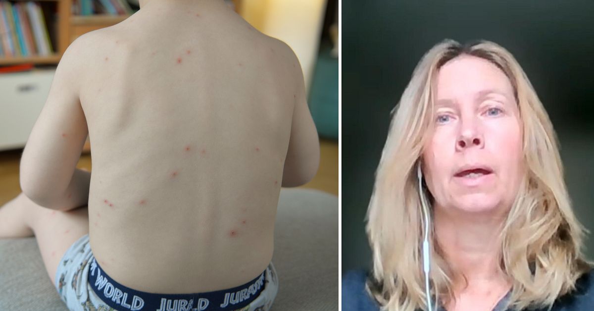 D&aring; inf&ouml;rs vattkoppsvaccinet i S&ouml;rmland &ndash; blir gratis f&ouml;r barn