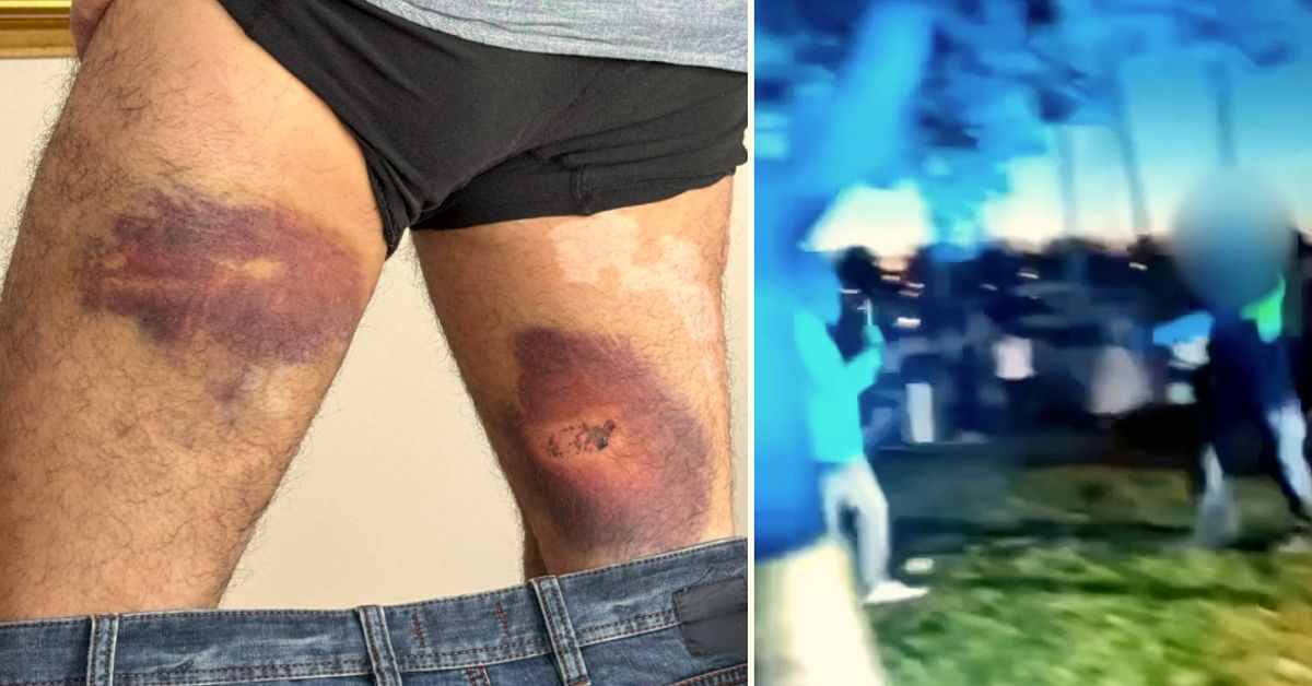 Här ger sig polisen på Fredrik med batong och pepparsprej