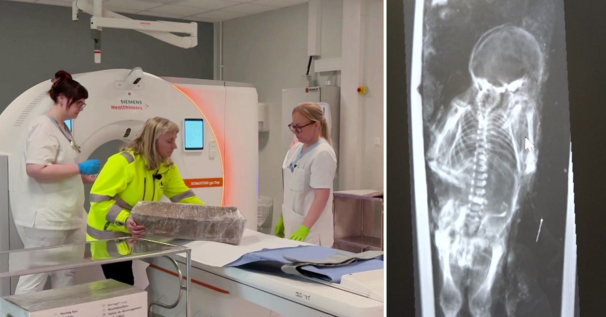 Unik uppt&auml;ckt &ndash; mumifierade barn har r&ouml;ntgats i Norrbotten