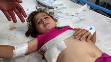 En skadad flicka på sjukhus i Rafah