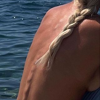Kritik om smalhetsideal efter Worges Instagrambild