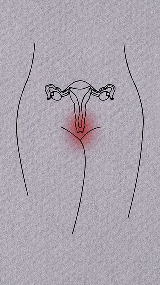 Det här är vaginism