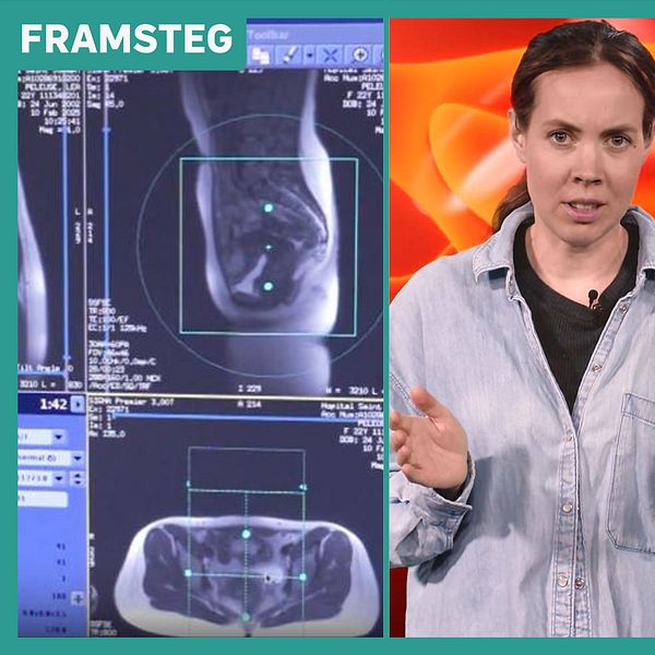 Bild till Framsteg