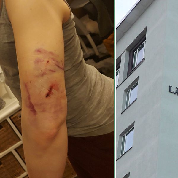 En bild på en skadad kvinnas arm och en bild på länsstyrelsen i Jönköping, exteriör.