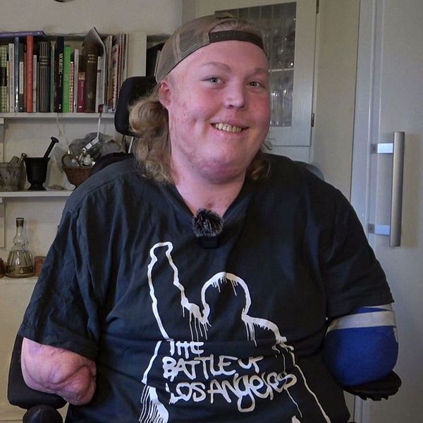 Viktor var 16 år när han fick sepsis och förlorade sina armar och ben.