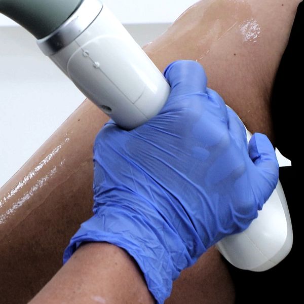 Bild som visar en hand iklädd en blå gummihandske som håller en behandlingapparat som används på en patients ben. Till vänster ses en närbild av behandlingstekniken, och till höger en person i vit läkarrock.