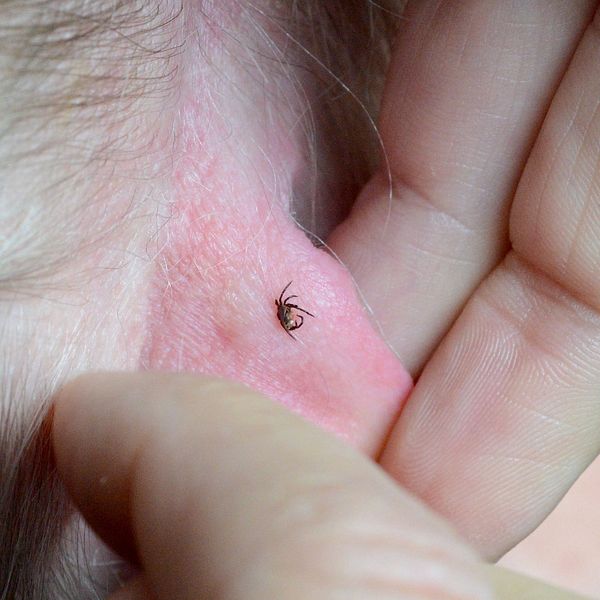 En delad bild som visar två olika scener. Den vänstra sidan visar en hand som håller i en liten fästing som sitter fast på huden. Den högra sidan visar en hand som hänger en julprydnad på en julgran, med en röd och en blå kula synliga på granen.