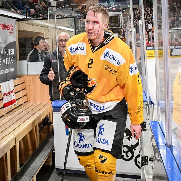 hockeyspelare med blod i ansiktet står i båset efter match