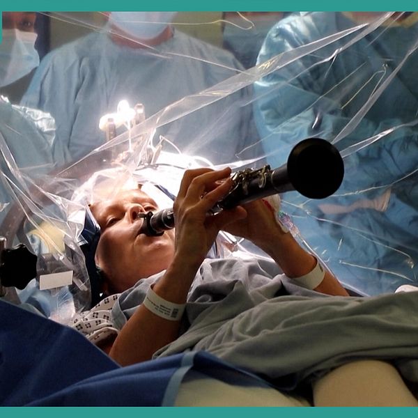 Denise Bacon spelar klarinett under en hjärnoperation omgiven av kirurger.