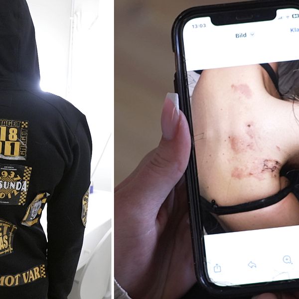 En delad bild som visar två sektioner. I den vänstra sektionen syns baksidan av en svart hoodie med olika emblem. I den högra sektionen håller en person en smartphone som visar en nära bild av ärr på en kvinnas rygg.