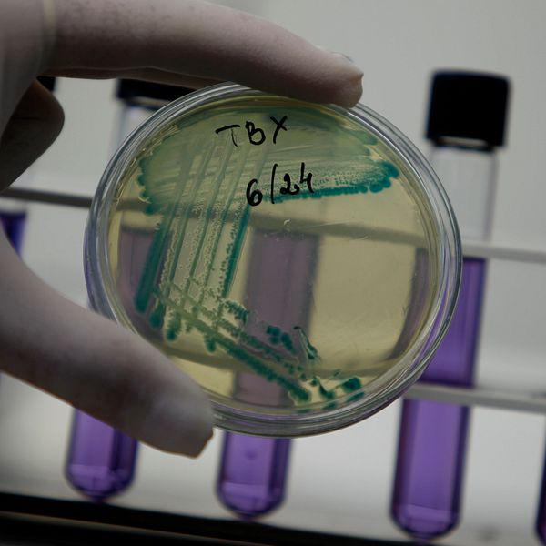 En laboratoriemedarbetsställd håller en petriskål med grönt odlad mikroorganism i ena handen.