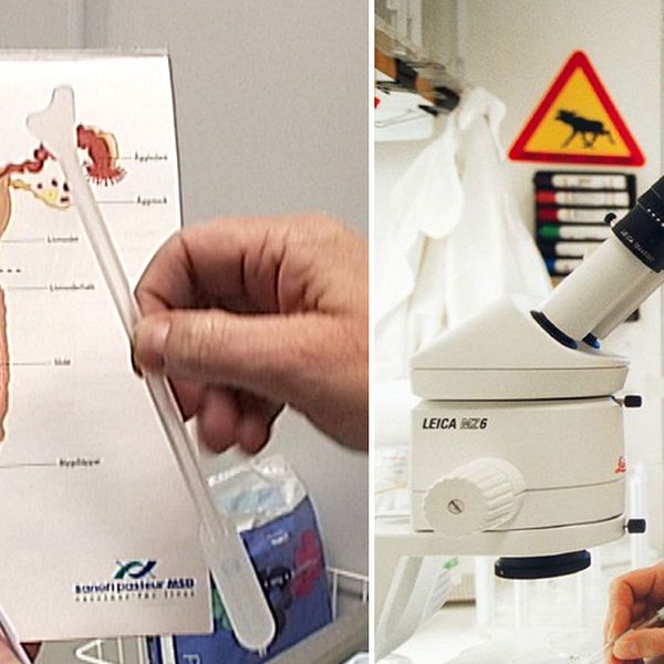 En bild på verktyg som används vid en cellprovtagning samt en läkare som analyserar prover i ett mikroskop.