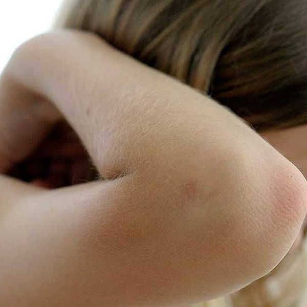 Flicka döljer ansiktet med armen, illustrerar barn som far illa.