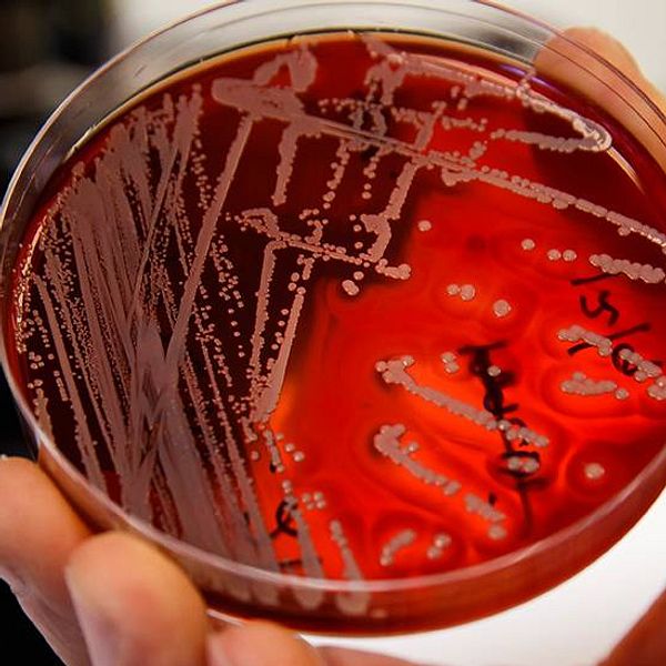 Många fall av multiresistenta bakterier