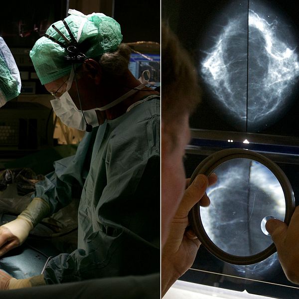 Bilder på operation och mammografi. Genrebilder.