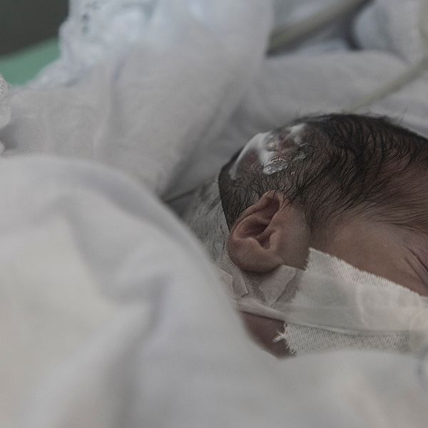 En förtidigt född bebis som kämpar för sitt liv.