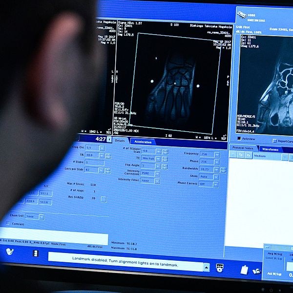 Mohassad Al Atia, röntgensjuksköterska, studerar bilderna från magnetkameran på sin skärm.