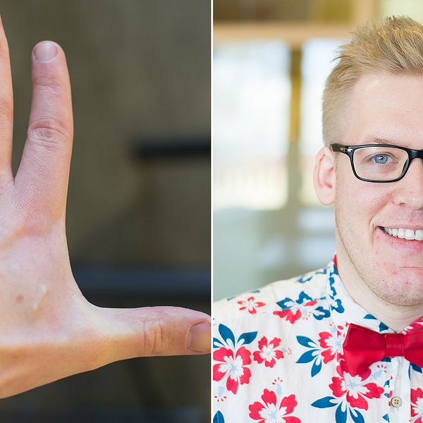 30-åriga Freddy Grip från Stockholm har implanterat två mikrochip, en i varje hand, sedan förra sommaren.