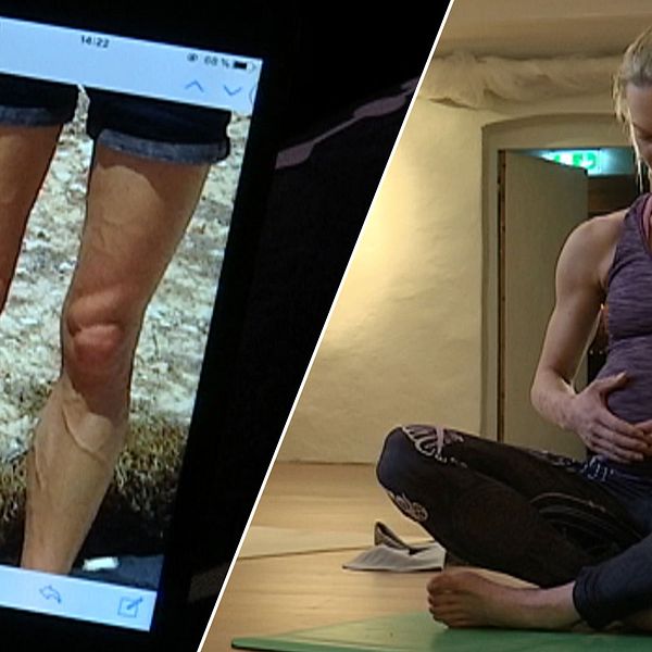 Bild på ben med synliga ådror och gravid kvinna som sitter i yoga-ställning.