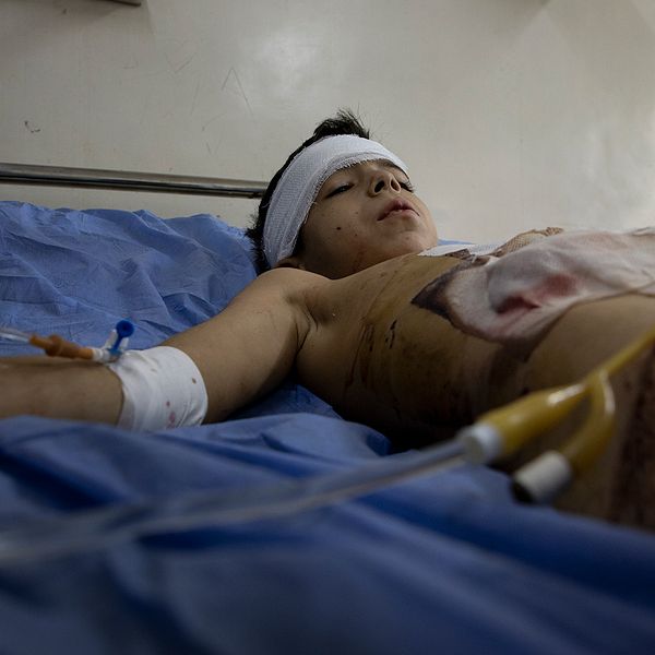 En splitterskadad pojke ligger på en sjukhussäng i Aleppo.