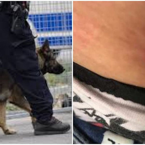 polishund och skador efter bettet
